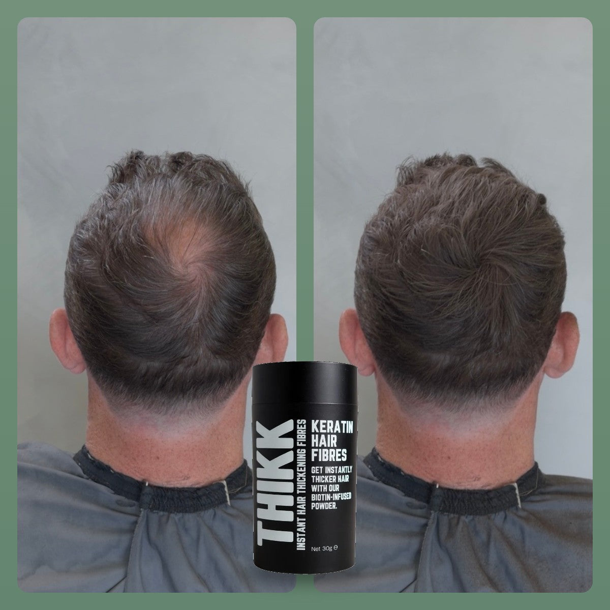 Before and after THIKK hair fibres on a thinning crown, with a 30g bottle
