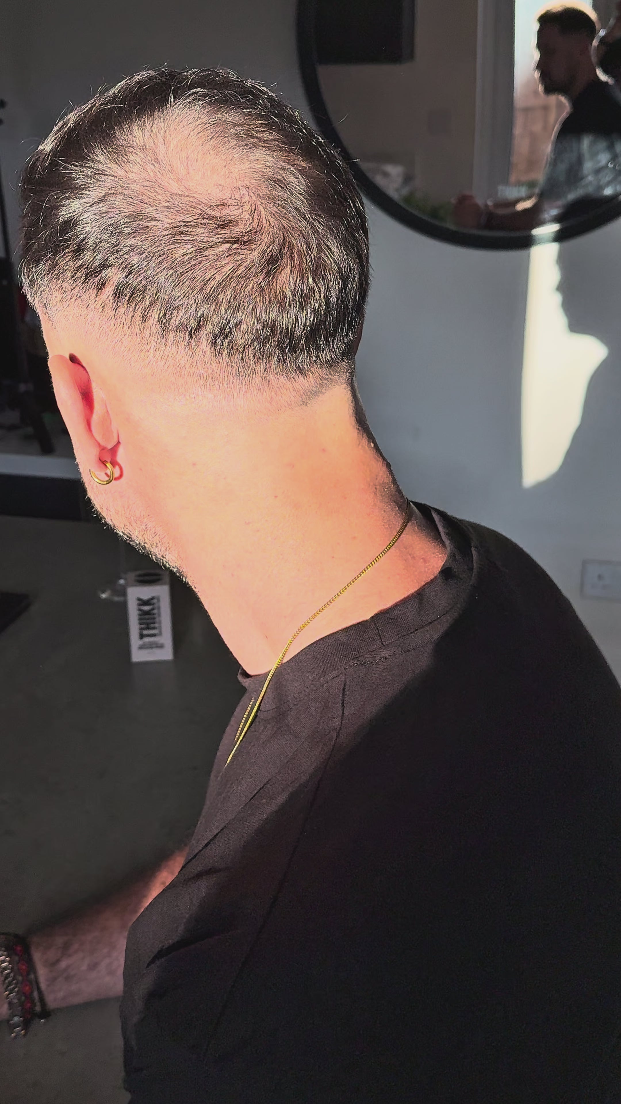 Load video: Selection of Customer Before &amp; Afters for THIKK Hair Fibres